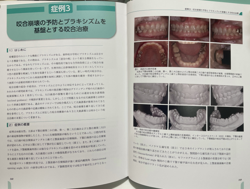 コンディログラフを用いた顎機能診断：歯科医師向け書籍